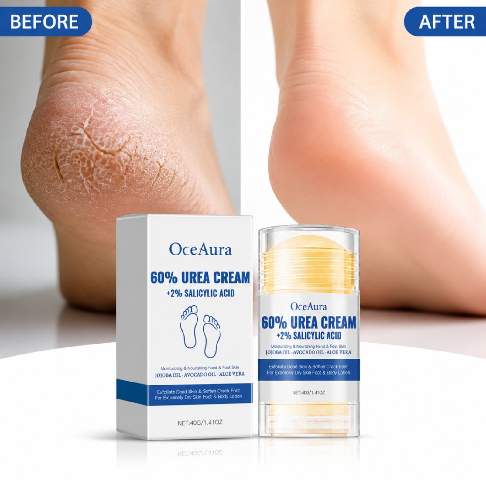 60% Urea Foot Care Cream Stick - Urea Foot Cream 评论和价格