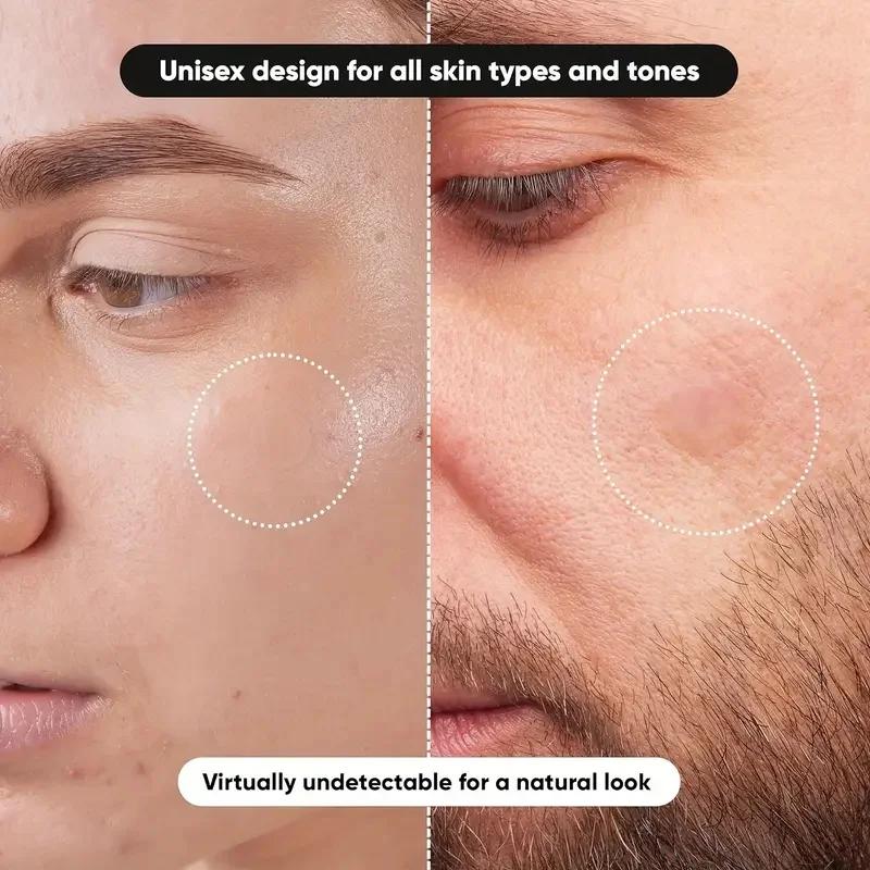 360 pieces/box acne patches -  - Face Oil 评论和价格