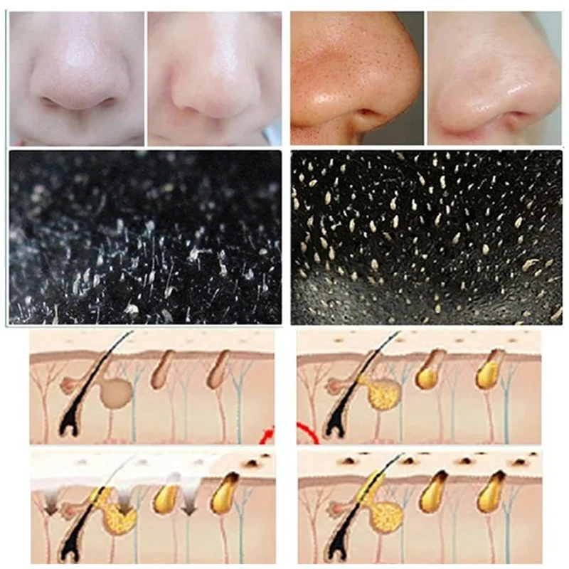 10pcs Blackhead Nose Strips De - Cleanser Face 评论和价格