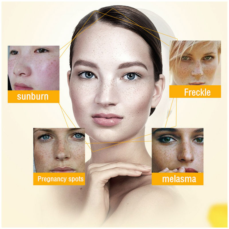 Dimollaure Whitening Freckle C - Retinol Cream 评论和价格