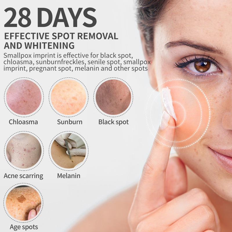 Dimollaure Whitening Freckle C - Retinol Cream 评论和价格