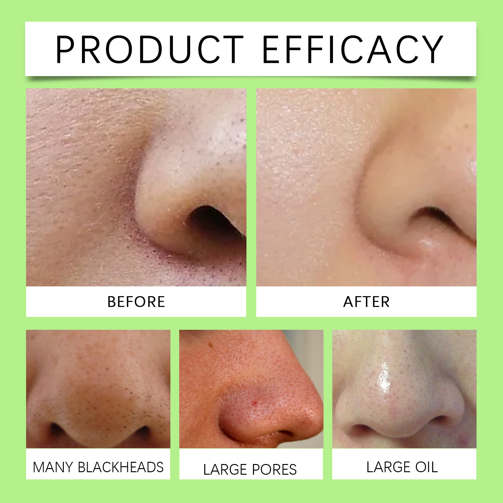 Bamboo Charcoal Nose Strips fo - Cleanser Face 评论和价格