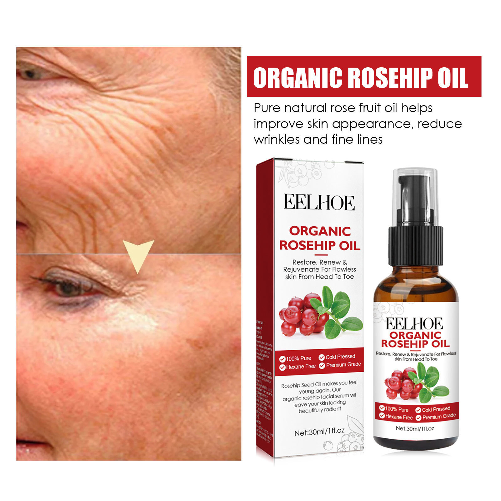 30ml Rosehip Oil Facial Serum  - Face Oil Rosehip 评论和价格